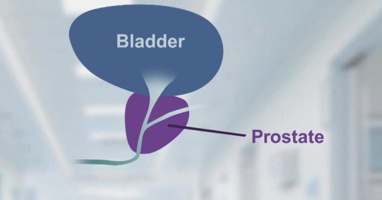 bladder-prostate-1280.jpg