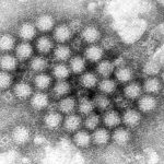 Norovirus_Infections-Things_to_Know_83384.jpg