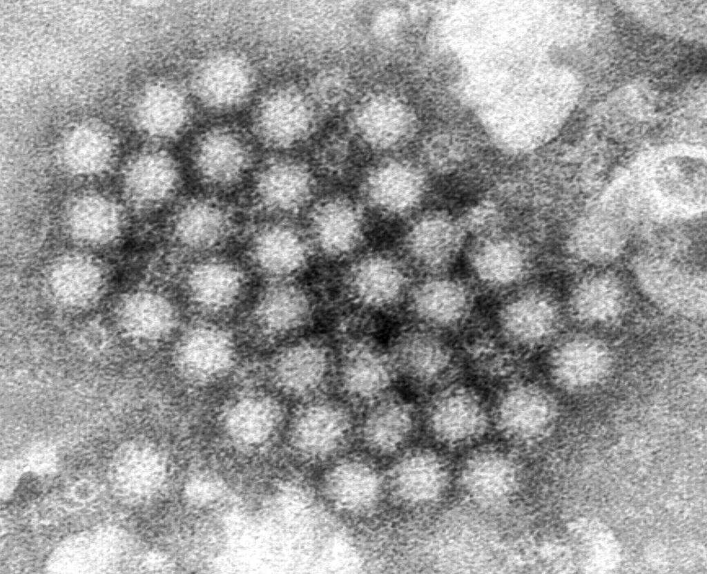 Norovirus_Infections-Things_to_Know_83384.jpg